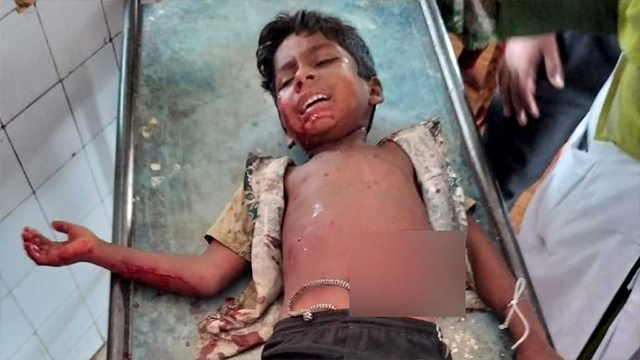 যশোরে বোমা বিস্ফোরণে আহত এক শিশুকে হাসপাতালে নেওয়া হচ্ছে।