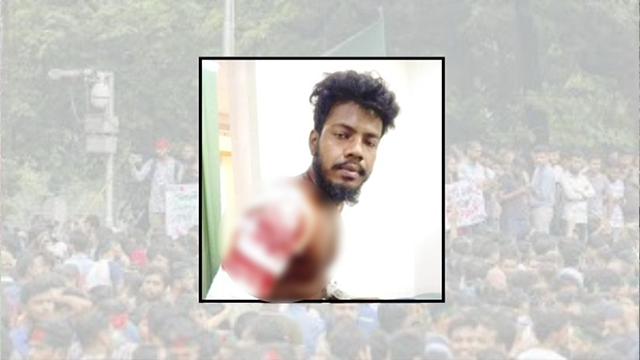 বৈষম্যবিরোধী ছাত্র আন্দোলনে গুলিতে আহত মোঃ আরিফুল ইসলাম রেজা। ছবি : সংগৃহীত